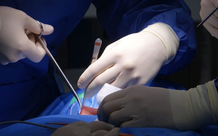 Cirurgiões com luvas manipulando instrumental durante cirurgia de coluna