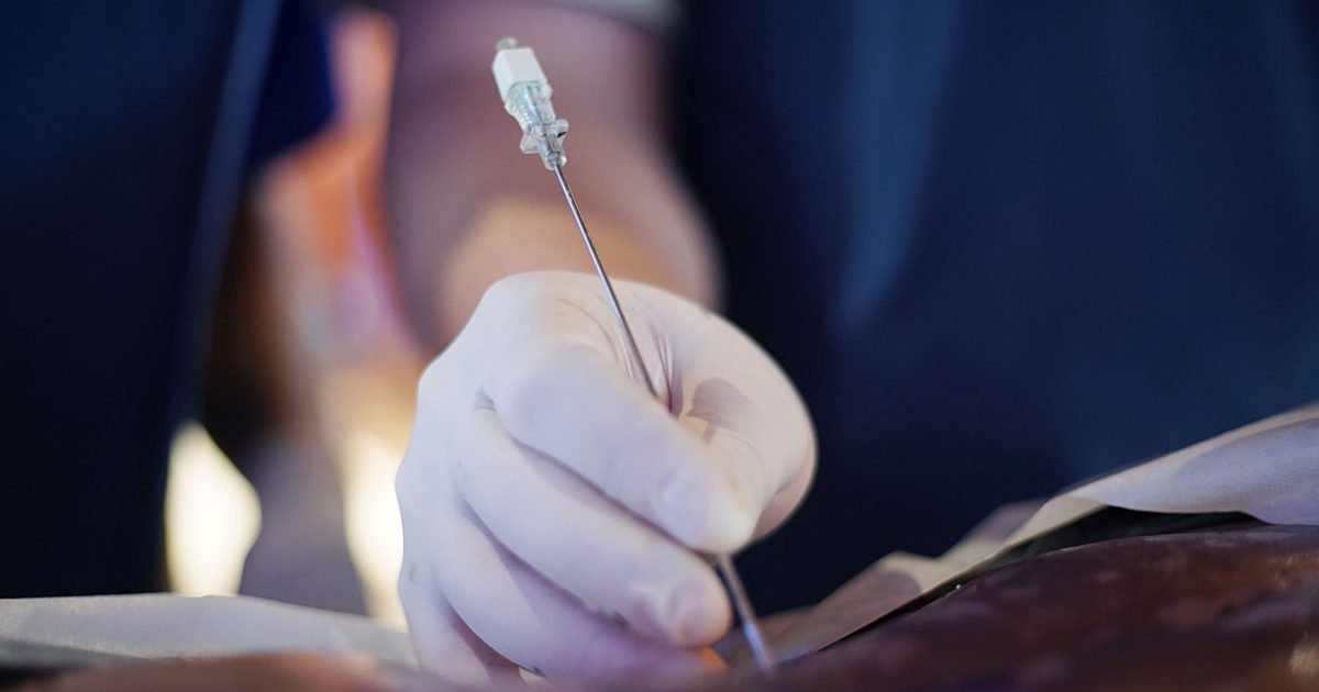 Punção guiada durante o treinamento de cirurgia endoscópica da coluna em cadáver